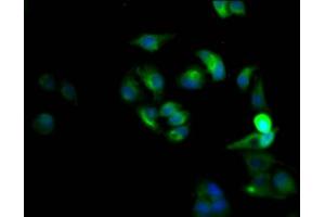 Immunofluorescence staining of Hela Cells with ABIN7127439 at 1:50, counter-stained with DAPI. (Recombinant CXCR4 抗体)