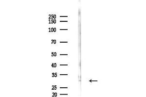 Western blot analysis of lysates from COLO205 cells(starvation 24h treatment), using CDK1/CDC2 Antibody at 1/1000 dilution.
