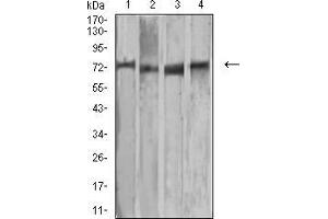 Western blot analysis using MMP2 mouse mAb against MCF-7 (1), Raw264. (MMP2 抗体  (AA 9-140))