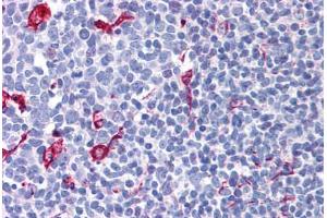 Human Tonsil (formalin-fixed, paraffin-embedded) stained with NET1 antibody ABIN299305 at 2. (NET1 抗体  (AA 611-624))