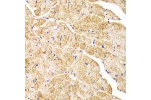 Immunohistochemistry (Paraffin-embedded Sections) (IHC (p)) image for anti-Actinin, alpha 1 (ACTN1) (AA 1-330) antibody (ABIN3021587)