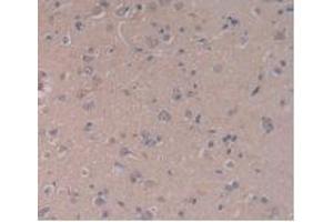 IHC-P analysis of Human Brain Tissue, with DAB staining. (TLR5 抗体  (AA 693-858))