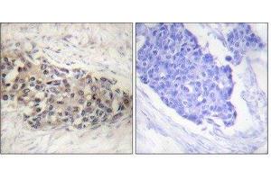 Immunohistochemistry (IHC) image for anti-Splicing Factor 1 (SF1) (Ser82) antibody (ABIN1847974) (Splicing Factor 1 抗体  (Ser82))