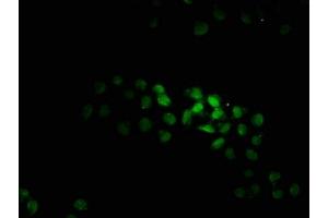 Immunofluorescence staining of Hela cells with ABIN7165725 at 1:100, counter-stained with DAPI. (KTI12 抗体  (AA 110-204))