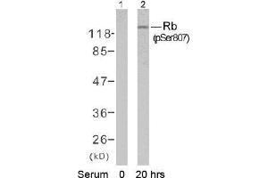 Image no. 1 for anti-Retinoblastoma 1 (RB1) (pSer807) antibody (ABIN196840) (Retinoblastoma 1 抗体  (pSer807))