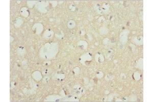 Immunohistochemistry of paraffin-embedded human brain tissue using ABIN7161608 at dilution of 1:100 (NINL 抗体  (AA 1-190))