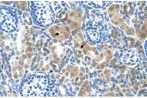 Immunohistochemistry (IHC) image for anti-Cystathionine-beta-Synthase (CBS) (N-Term) antibody (ABIN2782348)