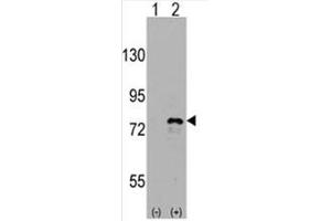 Image no. 2 for anti-DEAD (Asp-Glu-Ala-Asp) Box Polypeptide 3, X-Linked (DDX3X) (C-Term) antibody (ABIN357007) (DDX3X 抗体  (C-Term))
