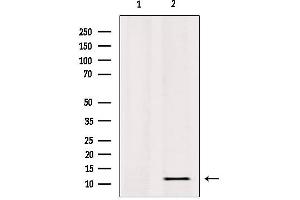 Western blot analysis of extracts from HepG2, using RPL36 Antibody. (RPL36 抗体  (C-Term))