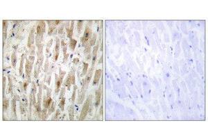 Immunohistochemistry (IHC) image for anti-LIM Domain Kinase 2 (LIMK2) (Internal Region) antibody (ABIN1849456) (LIMK2 抗体  (Internal Region))