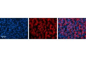 MAP2K3 antibody - C-terminal region          Formalin Fixed Paraffin Embedded Tissue:  Human Liver Tissue    Observed Staining:  Cytoplasm in hepatocytes   Primary Antibody Concentration:  1:100    Other Working Concentrations:  1/600    Secondary Antibody:  Donkey anti-Rabbit-Cy3    Secondary Antibody Concentration:  1:200    Magnification:  20X    Exposure Time:  0. (MAP2K3 抗体  (C-Term))
