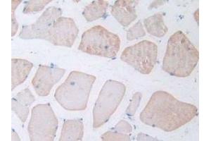 Detection of NT-ProANP in Rat Skeletal Muscle Tissue using Polyclonal Antibody to N-Terminal Pro-Atrial Natriuretic Peptide (NT-ProANP) (PRO-ANP 抗体  (AA 25-122))