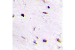 Immunohistochemical analysis of QDPR staining in human brain formalin fixed paraffin embedded tissue section. (QDPR 抗体)