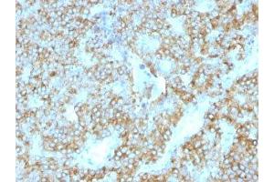 Formalin-fixed, paraffin-embedded human parathyroid stained with PTH antibody (PTH/1175). (PTH 抗体  (AA 32-115))