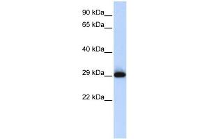 SUSD3 antibody used at 1 ug/ml to detect target protein. (SUSD3 抗体  (N-Term))