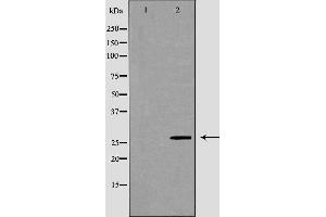 Western blot analysis of Hela whole cell lysates, using VAPB Antibody. (VAPB 抗体  (C-Term))