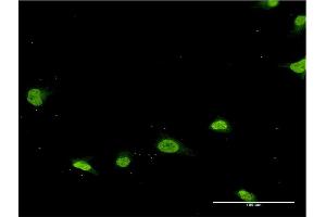 Immunofluorescence of monoclonal antibody to PSMB8 on HeLa cell. (PSMB8 抗体  (AA 173-272))