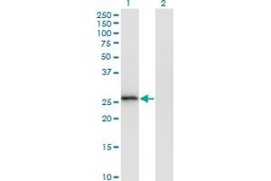 Western Blot analysis of MS4A6A expression in transfected 293T cell line by MS4A6A monoclonal antibody (M02), clone 2D12. (MS4A6A 抗体  (AA 1-248))