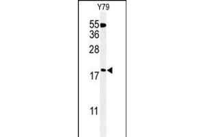 Western Blotting (WB) image for anti-Thioredoxin Domain Containing 12 (Endoplasmic Reticulum) (TXNDC12) (AA 144-172), (C-Term) antibody (ABIN651065)