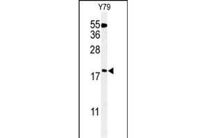Western blot analysis of TXNDC12 Antibody (C-term) (ABIN651065 and ABIN2840056) in Y79 cell line lysates (35 μg/lane). (TXNDC12 抗体  (C-Term))