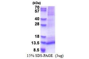 SDS-PAGE (SDS) image for Receptor (G Protein-Coupled) Activity Modifying Protein 1 (RAMP1) (AA 27-117) protein (His tag) (ABIN5853491)