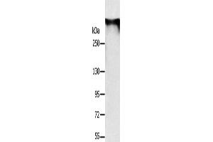 Western Blotting (WB) image for anti-Ryanodine Receptor 1 (Skeletal) (RYR1) antibody (ABIN2433723) (RYR1 抗体)