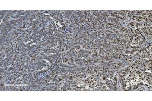 IHC analysis of Transketolase/TKT using anti-Transketolase/TKT antibody (ABIN7598958).
