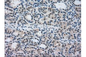 Immunohistochemical staining of paraffin-embedded Ovary tissue using anti-STK39mouse monoclonal antibody. (STK39 抗体)