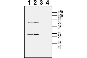 Western blot analysis of mouse brain lysate (lanes 1 and 3) and rat brain lysate (lanes 2 and 4):1-2. (CD9 抗体  (Extracellular))