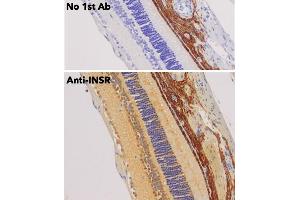 Immunohistochemistry (IHC) image for anti-Insulin Receptor (INSR) (C-Term) antibody (ABIN6254165) (Insulin Receptor 抗体  (C-Term))