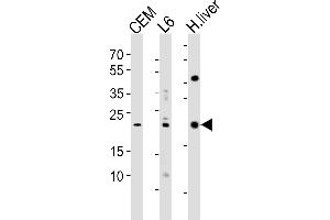 Western blot analysis of lysates from CEM, rat L6 cell line and human liver tissue lysate(from left to right), using PEMT Antibody (N-term) (ABIN650614 and ABIN2844055). (PEMT 抗体  (N-Term))