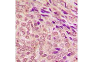 Immunohistochemistry (IHC) image for anti-Signal Transducer and Activator of Transcription 3 (Acute-Phase Response Factor) (STAT3) (C-Term) antibody (ABIN7297044)