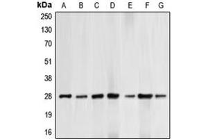 Western blot analysis of BCL2 (pT69) expression in HepG2 UV-treated (A), HeLa (B), HL60 (C), THP1 (D), Jurkat paclitaxel-treated (E), NIH3T3 H2O2-treated (F), PC12 H2O2-treated (G) whole cell lysates. (Bcl-2 抗体  (pSer69))