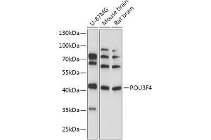 Western blot analysis of extracts of various cell lines, using POU3F4 antibody (ABIN7269496) at 1:1000 dilution. (POU3F4 抗体  (AA 1-190))