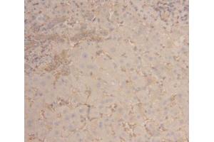 Detection of ACTG in Human Liver Tissue using Polyclonal Antibody to Gamma Actin (ACTG) (Actin, gamma 1 抗体  (AA 1-375))