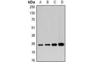Western blot analysis of APIP expression in 22RV1 (A), mouse heart (B), mouse liver (C), rat stomach (D) whole cell lysates. (APIP 抗体)