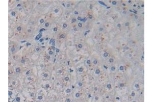 Detection of AMH in Human Liver Tissue using Monoclonal Antibody to Anti-Mullerian Hormone (AMH)