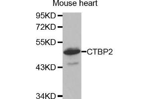 Western Blotting (WB) image for anti-C-terminal Binding Protein 2 (CTBP2) (C-Term) antibody (ABIN1679396) (CTBP2 抗体  (C-Term))