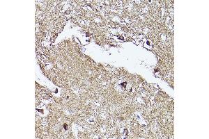 Immunohistochemistry (IHC) image for anti-Voltage-Dependent Anion Channel 2 (VDAC2) (AA 1-100) antibody (ABIN7271337)