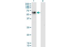 Western Blot analysis of CD44 expression in transfected 293T cell line by CD44 monoclonal antibody (M05), clone 2H5. (CD44 抗体  (AA 1-699))