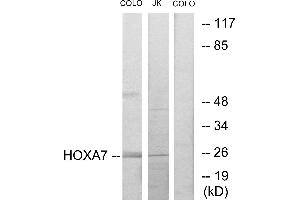 Western blot analysis of extracts from COLO205 cells and Jurkat cells, using HOXA7 antibody. (HOXA7 抗体  (Internal Region))