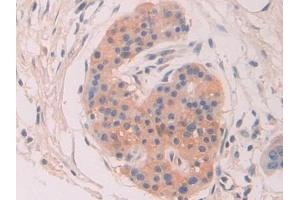 Immunohistochemistry (IHC) image for anti-Chordin (CHRD) (AA 700-918) antibody (ABIN7442051)