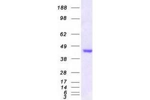 Western Blotting (WB) image for Methylthioribose-1-Phosphate Isomerase 1 (Mri1) (Transcript Variant 1) protein (Myc-DYKDDDDK Tag) (ABIN2726324)