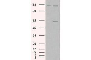 Western Blotting (WB) image for anti-Monoamine Oxidase A (MAOA) (Internal Region) antibody (ABIN2465953) (Monoamine Oxidase A 抗体  (Internal Region))