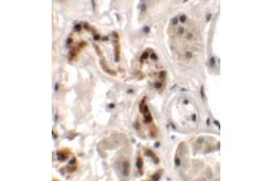 Immunohistochemistry of DBX1 in human kidney tissue with DBX1 antibody at 2. (DBX1 抗体  (Middle Region))