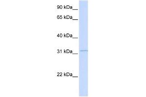 RDH12 antibody used at 1 ug/ml to detect target protein. (RDH12 抗体)