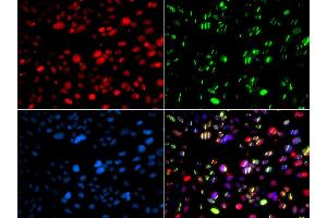 Immunofluorescence analysis of GFP-RNF168 transgenic U2OS cells using PNKP antibody.