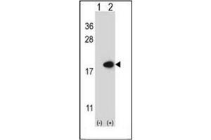 Western blot analysis of FABP2 (arrow) using FABP2 Antibody (N-term) Cat. (FABP2 抗体  (N-Term))