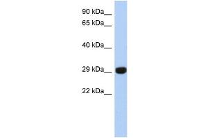 WB Suggested Anti-FN3KRP Antibody Titration: 0. (FN3KRP 抗体  (N-Term))