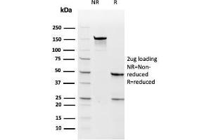 SDS-PAGE Analysis Purified TYMS Recombinant Mouse Monoclonal Antibody (rTYMS/1884). (Recombinant TYMS 抗体  (AA 60-174))